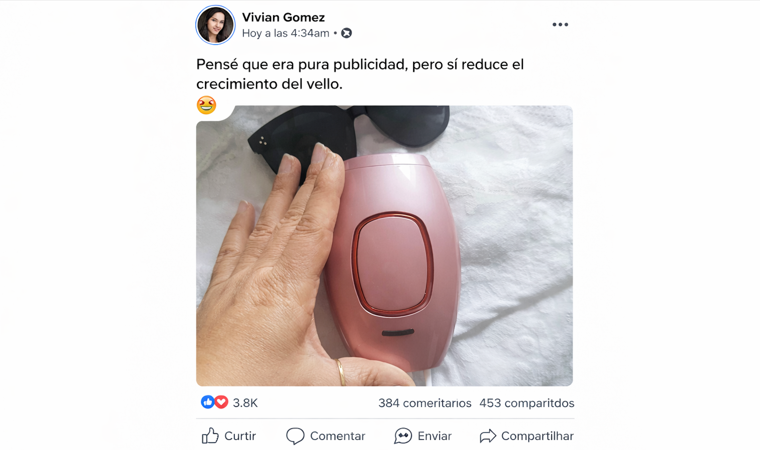 Depiladora Láser IPL Profesional – Piel Suave Sin Dolor Desde Casa